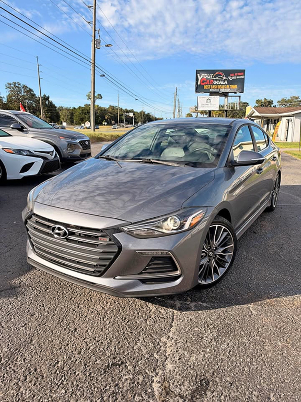 2017 Hyundai Elantra